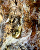 Benzoin Tears Loas